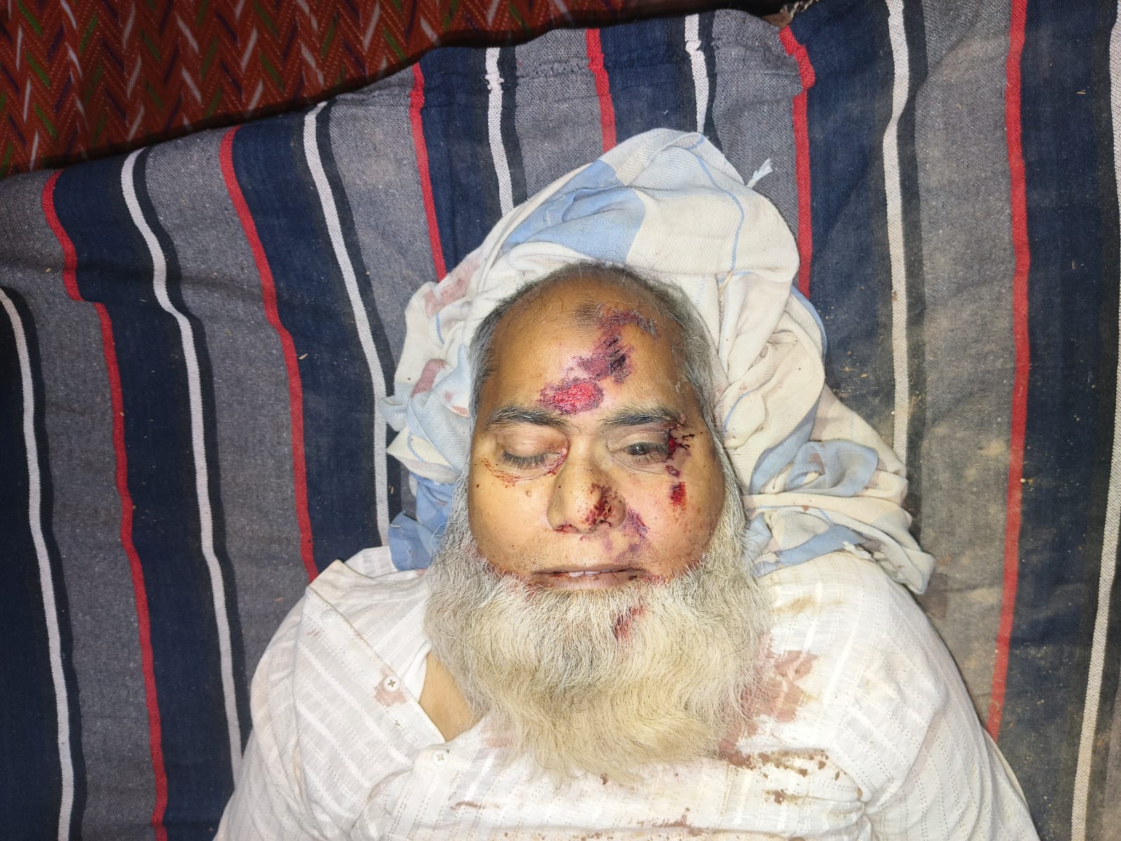 अज्ञात चार पहिया वाहन की टक्कर से 60 वर्षीय व्यक्ति की मौत